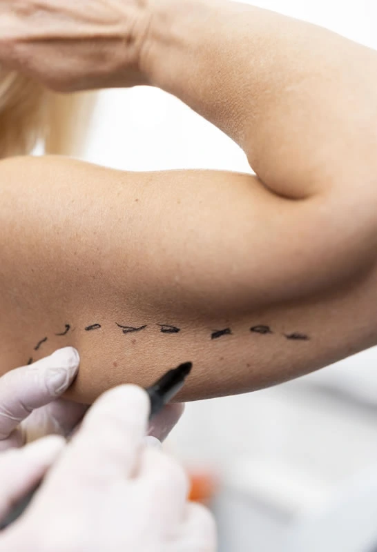 transformación corporal<br />
